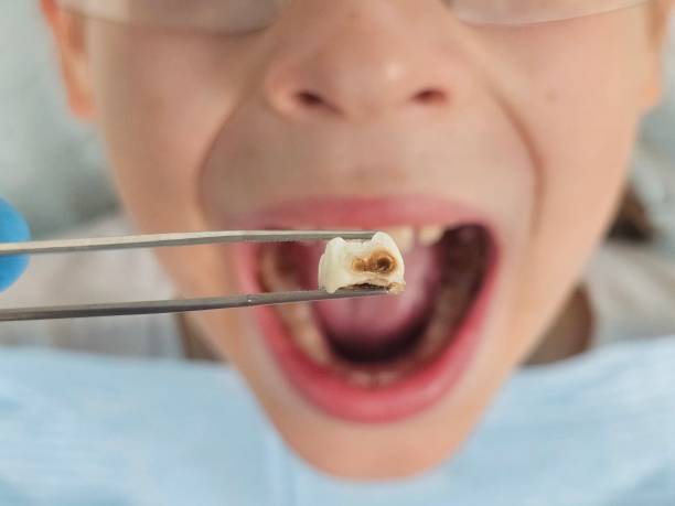 Best Emergency Dentist for Special Needs Patients in Stuart, IA